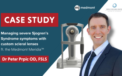 Case study: Managing severe Sjögren’s Syndrome ft. the Medmont Meridia™
